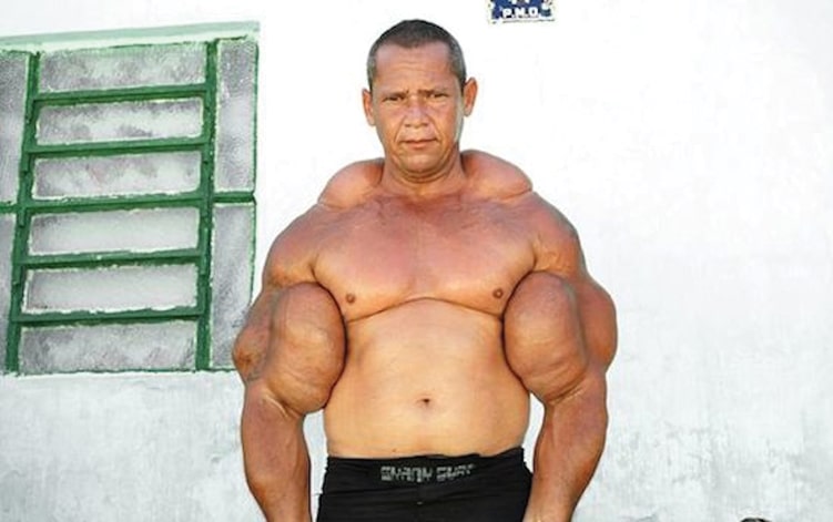 Olie arme -3